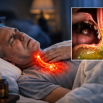 Can You Die From Acid Reflux in Your Sleep